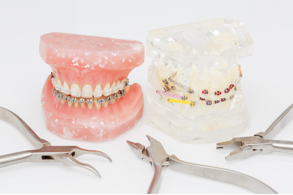 Orthodontic treatment